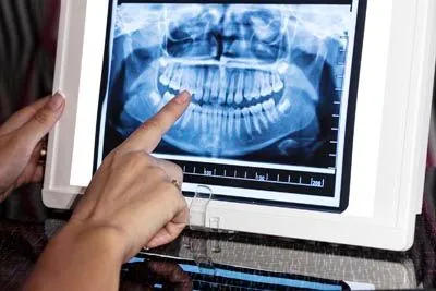 AZ Dental staff reviewing a patient's dental x-rays