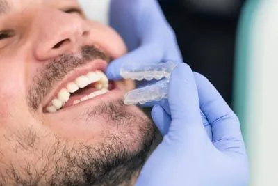 patient getting fitted for his Invisalign clear aligners at AZ Dental