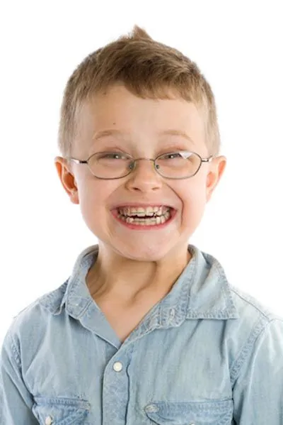 young child smiling big with his new braces